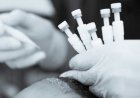 DHİ زراعة الشعر بتقنية