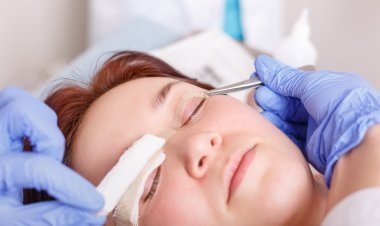 Blepharoplasty
