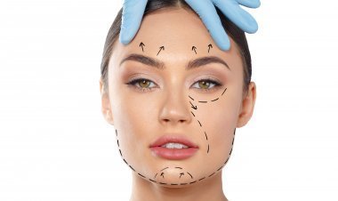 Brow Lifting