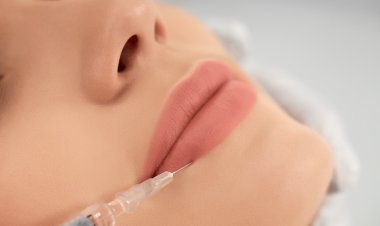 Lip Augmentation